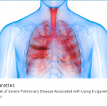 CDC's Outbreak of Severe Lung Injury